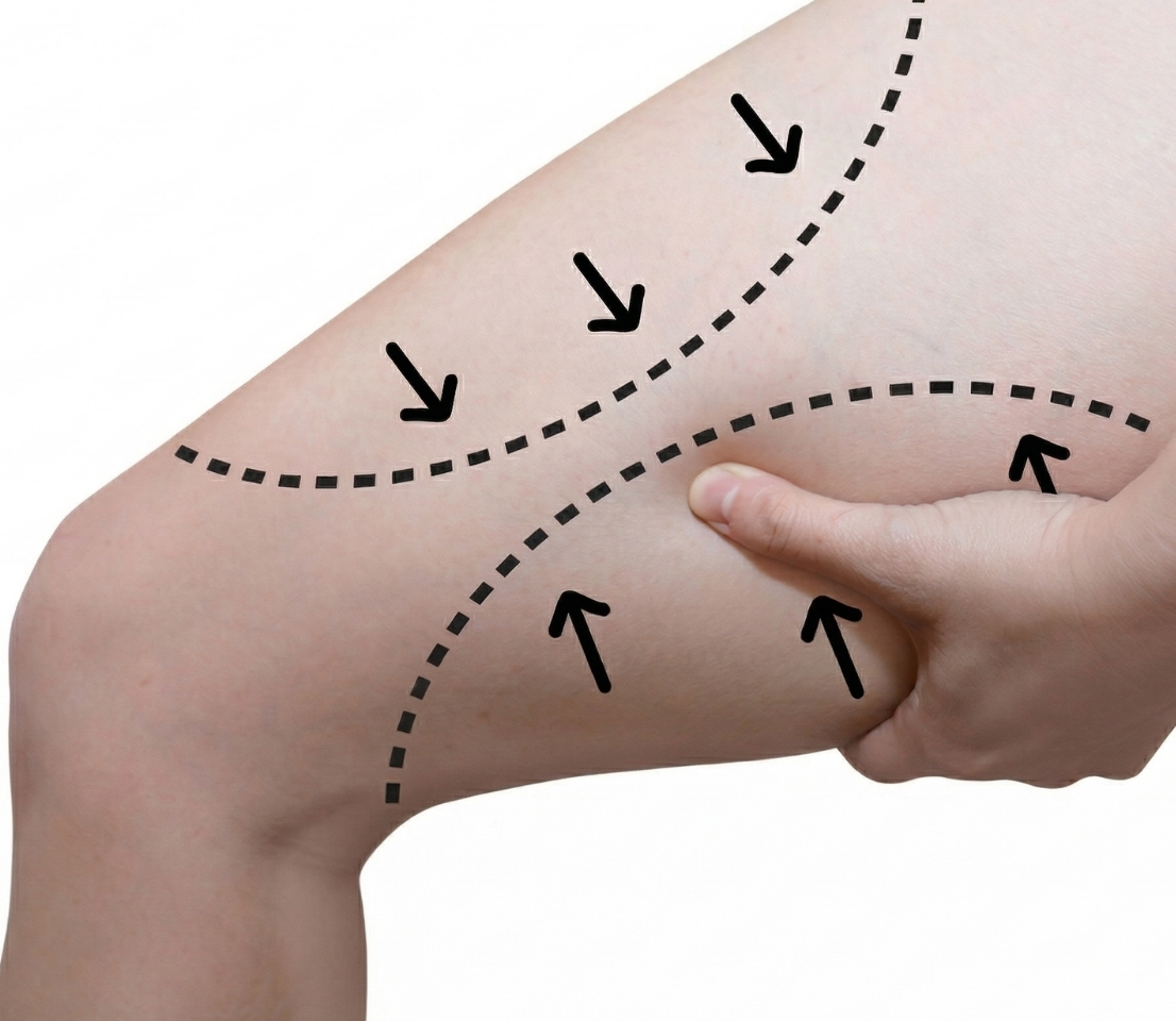 Bacak Şekillendirme